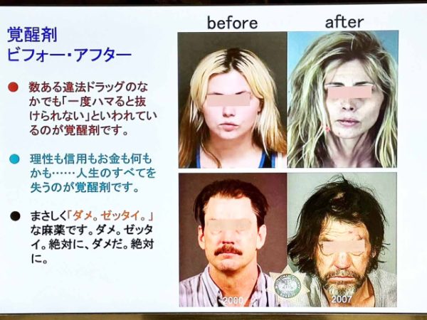 コカイン離脱に対する治療の選択肢